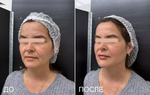 Результат 8
